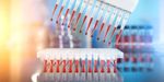 Ultrasensitive Assays: Technology, Applications, and Benefits