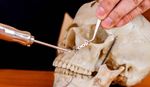Maxillofacial Implant Manufacturing Basics: Learn How Modern Implants Are Created